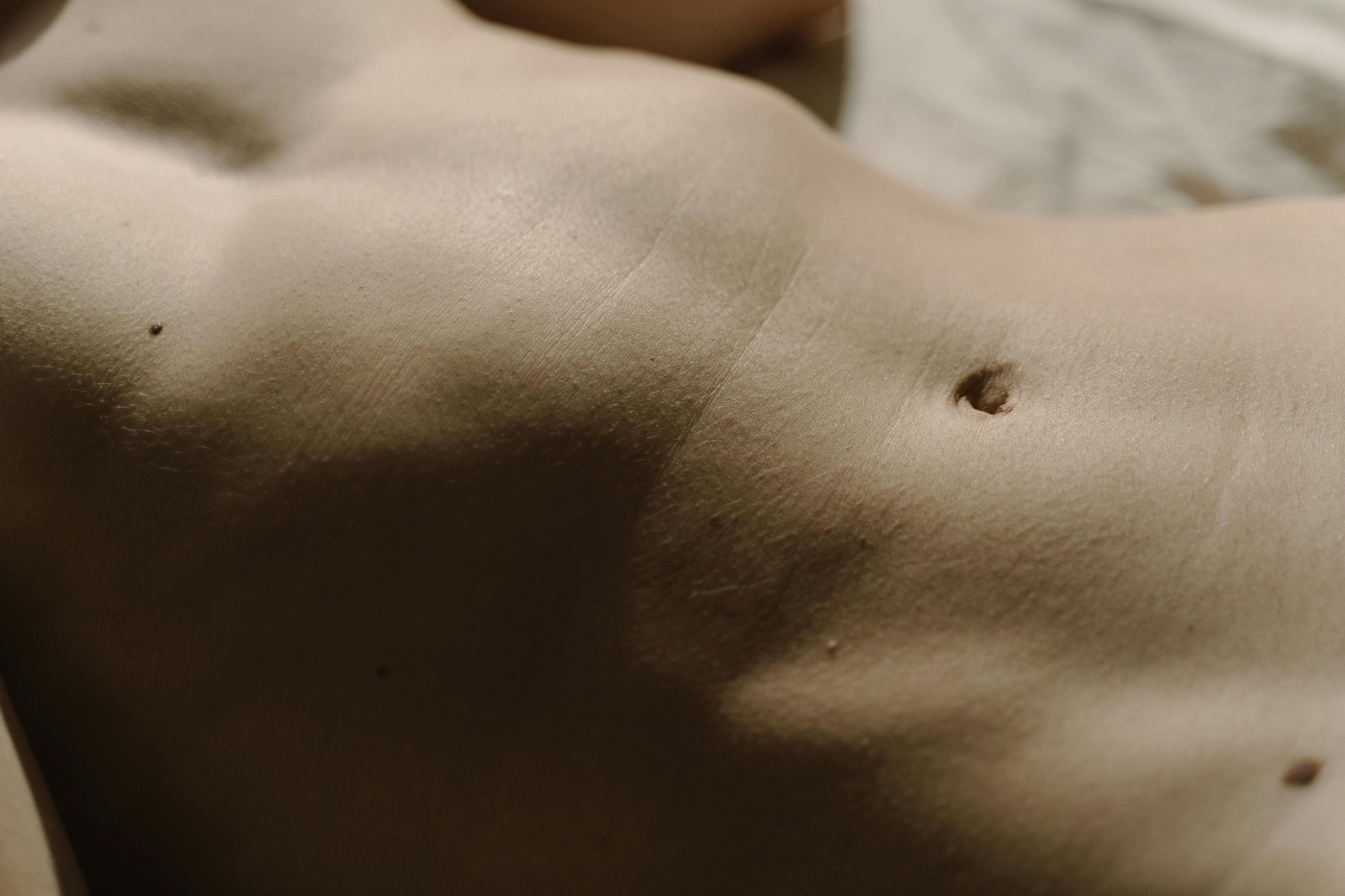 CoolSculpting®